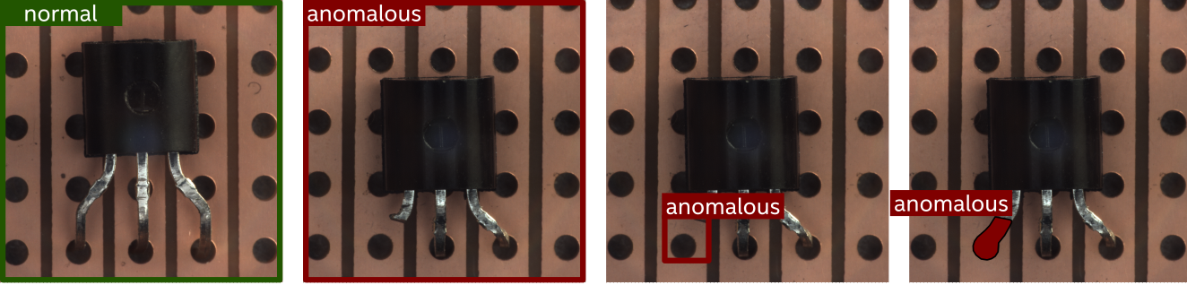 Anomaly Task Types